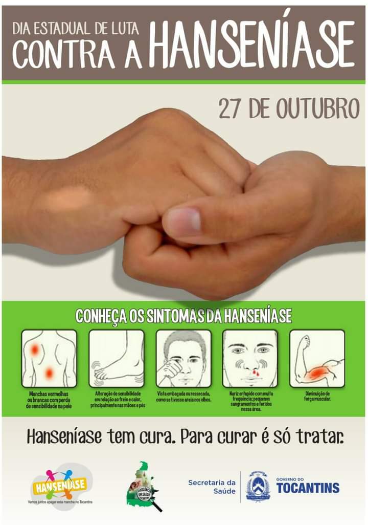 HANSENÍASE    O MAIOR PROBLEMA AINDA É O&nbsp;PRECONCEITO
